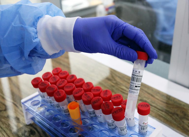 37 new COVID-19 cases confirmed in Simcoe Muskoka, local total reaches 2,584