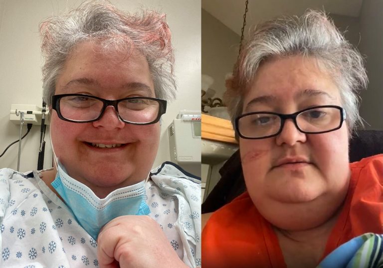 ‘I made it’: Alberta COVID-19 patient replies to ICU doctor’s tearful tweet
