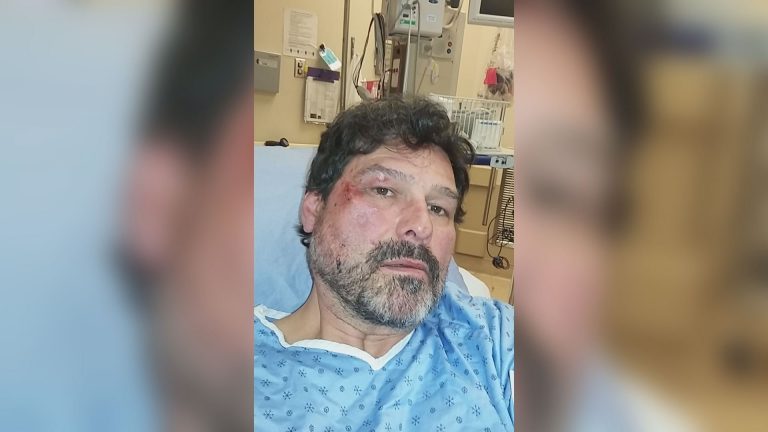 Man accused in Kelowna, B.C., bus driver assault pleads guilty