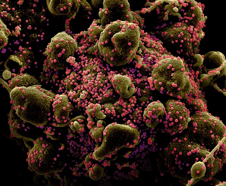 20 new coronavirus cases, 31 recoveries reported in London-Middlesex: MLHU