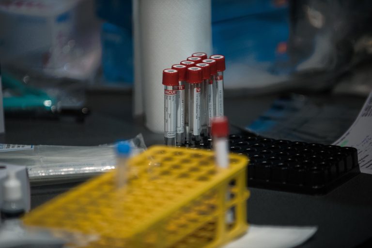 Coronavirus: 36 new U.K. variant COVID-19 cases confirmed in Simcoe Muskoka