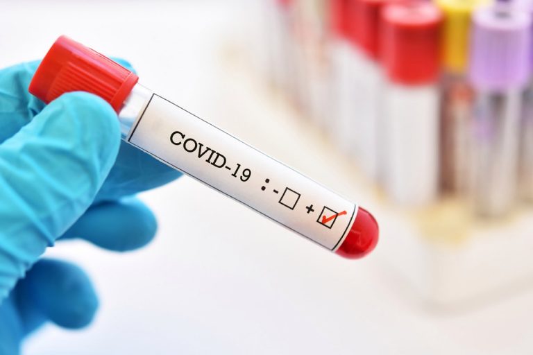 Guelph reports 17 new COVID-19 cases, active cases at 116