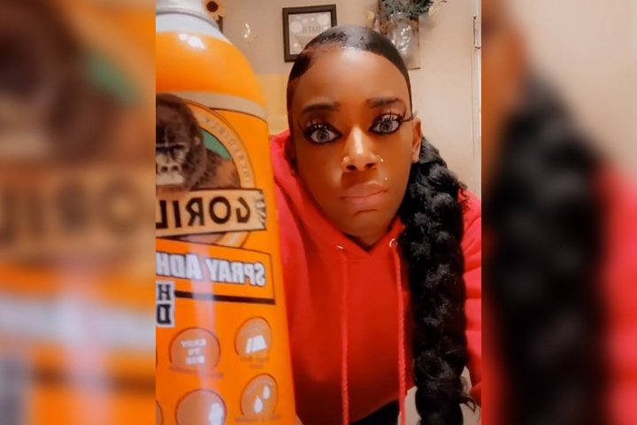 Surgeon saves ‘Gorilla Glue girl’ who sealed her hair with superglue
