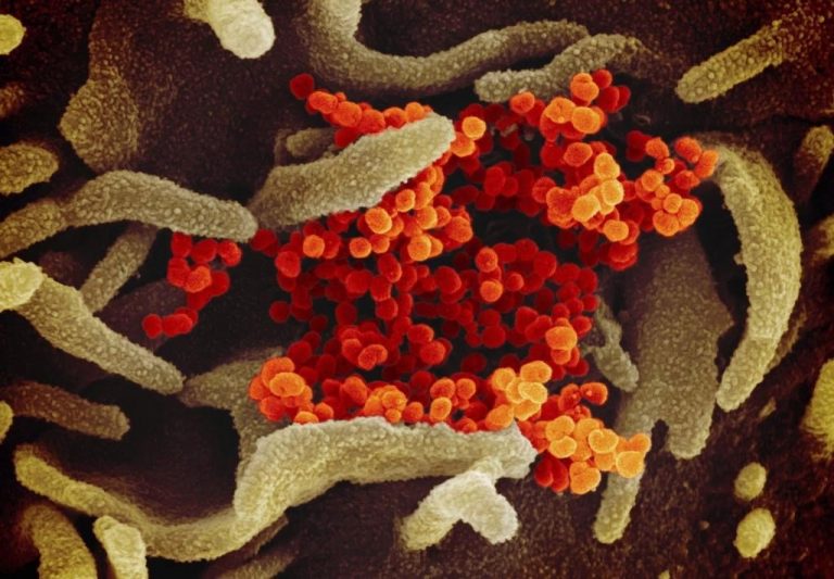30 more positive tests for COVID-19 reported in Waterloo Region
