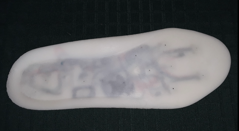 Red River College students develop electronic shoe sole to prevent injuries to diabetic patients