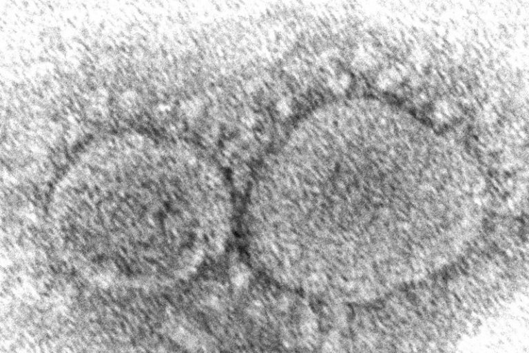 Past COVID-19 infection not a ‘free pass’ from new variants, experts say