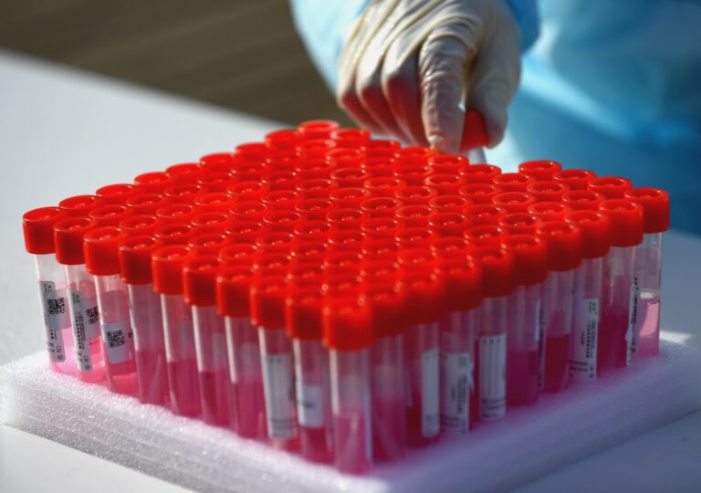 141 new COVID-19, 120 additional variant cases confirmed in Simcoe Muskoka