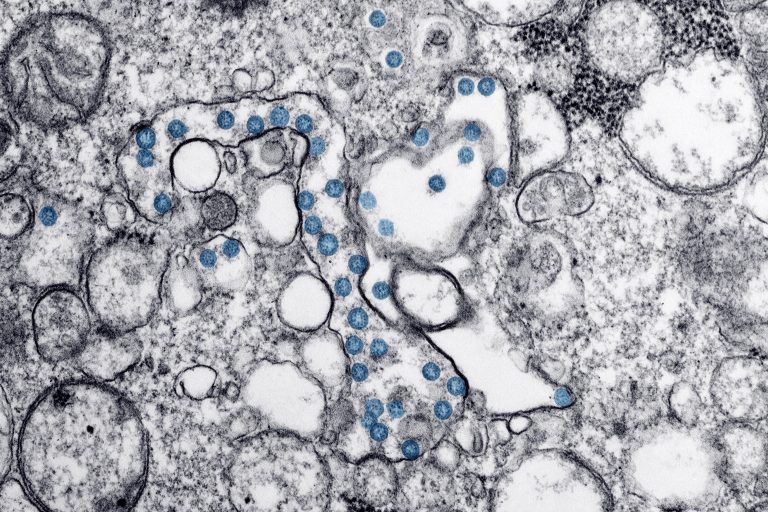 South African coronavirus variant found in Manitoba: health officials