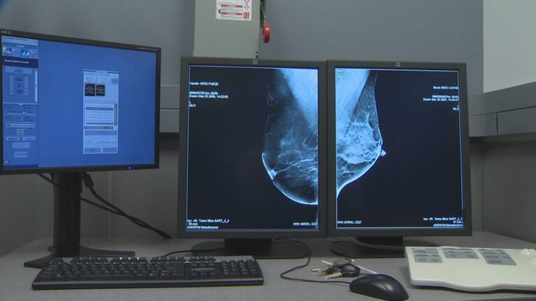Coronavirus: Doctors worry about Ontario’s low rate of cancer screenings during pandemic