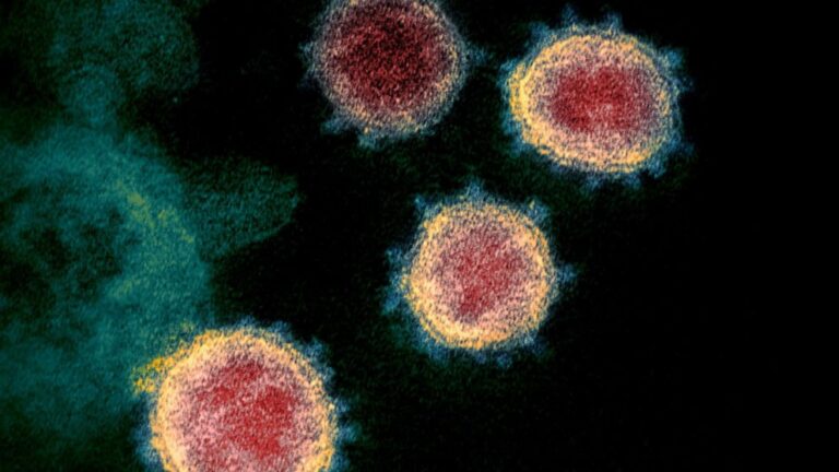 FDA authorizes new T-cell test that could be game changer for COVID-19 long haulers