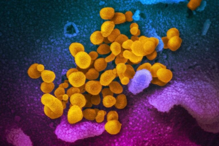 26 global experts call for new investigation into COVID-19 origins