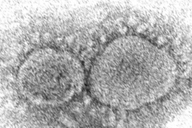 Kelowna included in global study for COVID-19 treatments
