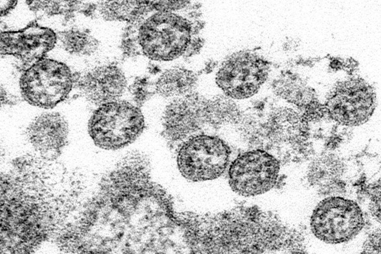 New COVID-19 cases in Waterloo Region continue to trend downward