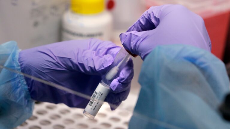 Saskatchewan sets new records for daily and active COVID-19 cases