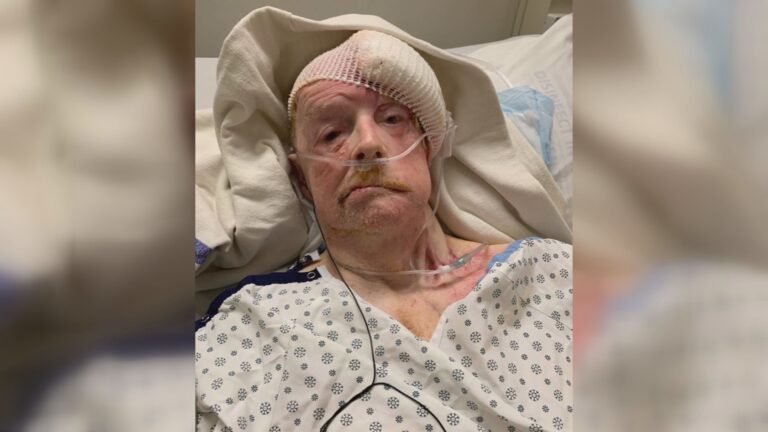 Edmonton man’s surgery cancelled moments before it was set to begin