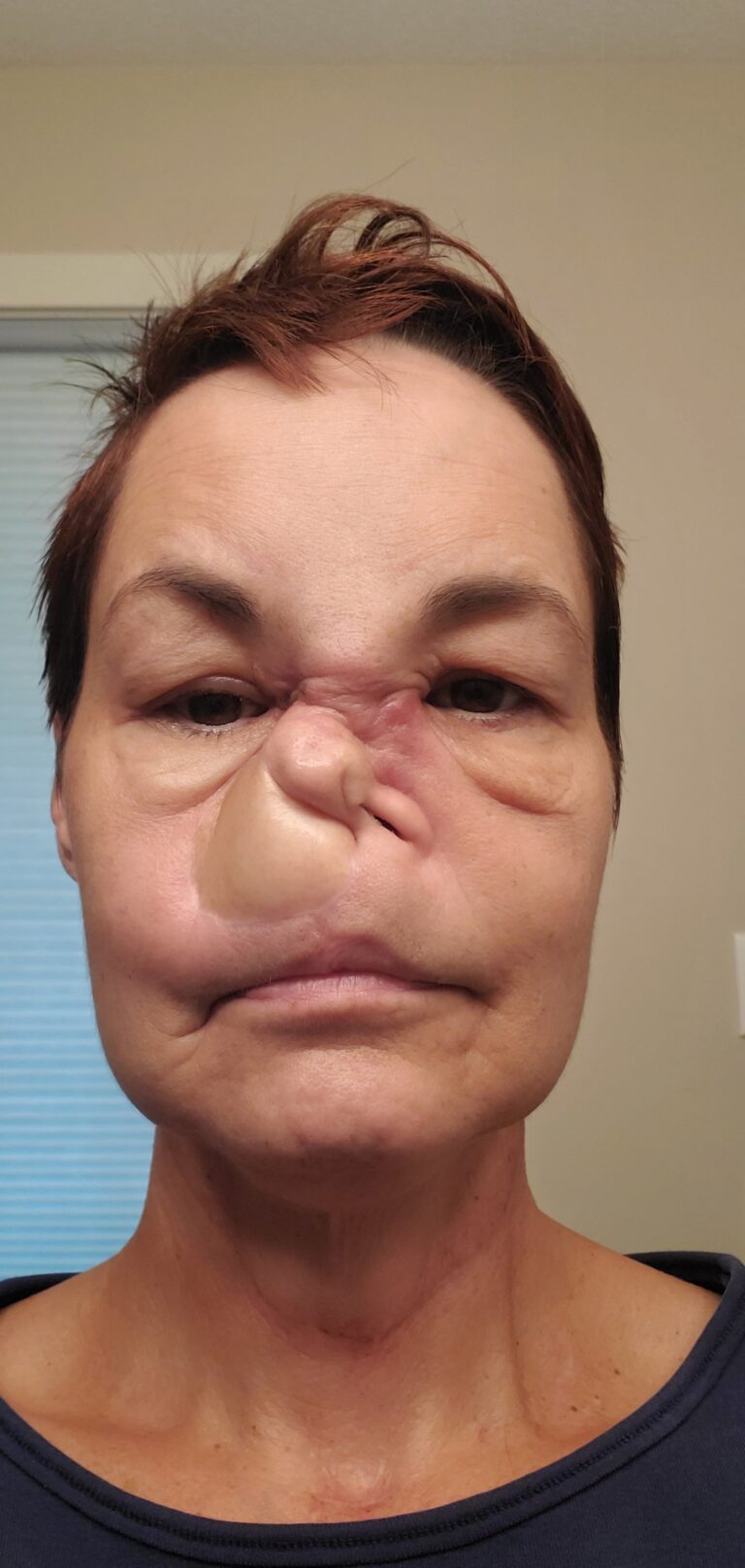 COVID-19: Saskatchewan woman scared after surgery in Alberta cancelled