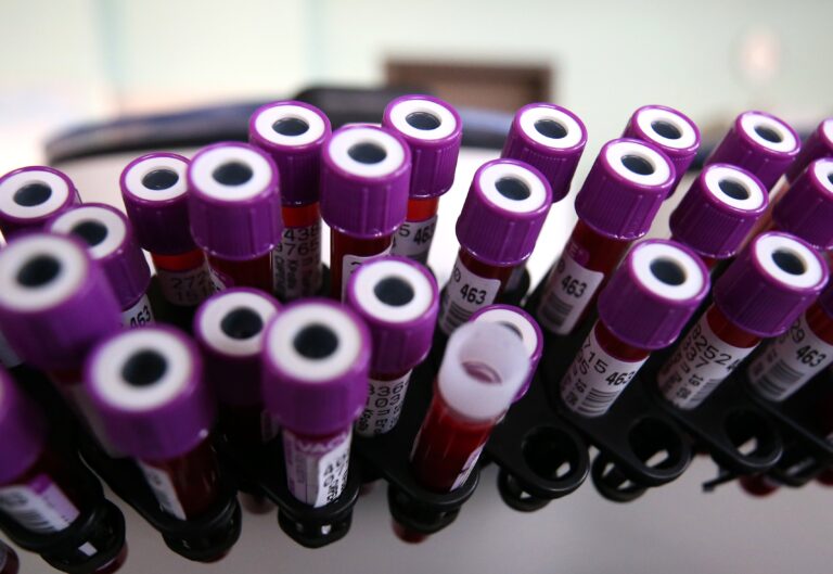 Russia counting on COVID-19 antibody tests. Western experts say it’s unwise
