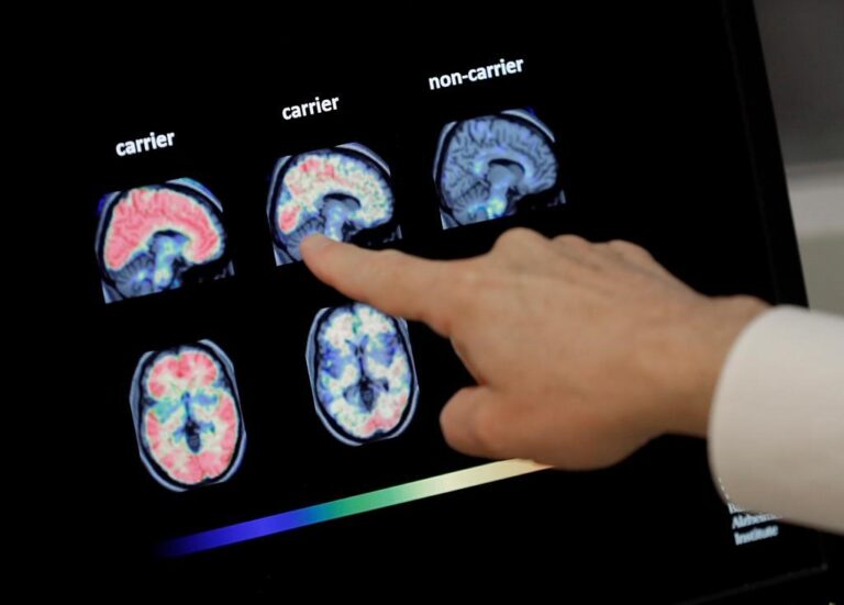 Report rules out food, environmental exposures in mysterious N.B. neurological disease