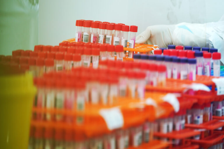 Ontario reports 711 new COVID-19 cases, highest single-day count in nearly 2 months