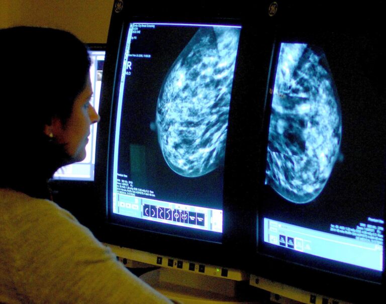 Studies that shaped Canada’s breast cancer screening guidelines ‘flawed,’ researchers say