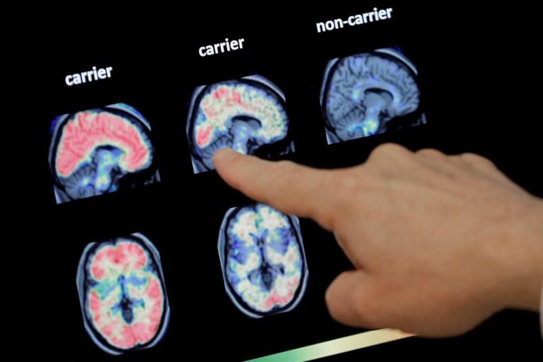 Oversight committee rules out mysterious brain disease in New Brunswick