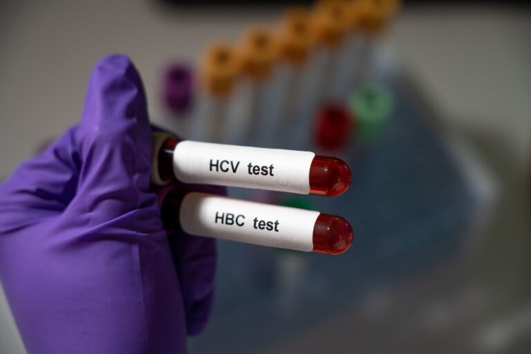 Severe hepatitis in kids: Theories emerge for cause of mysterious illness