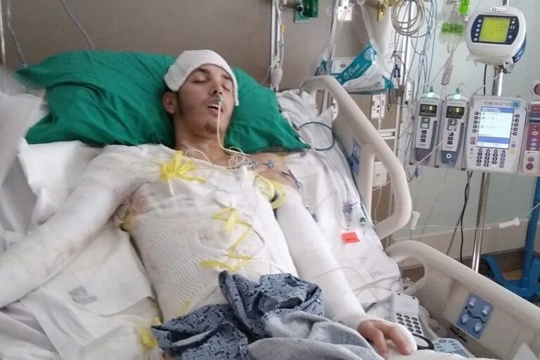 Florida man ‘cooked alive’ after police use stun gun in gas station arrest, lawyers say