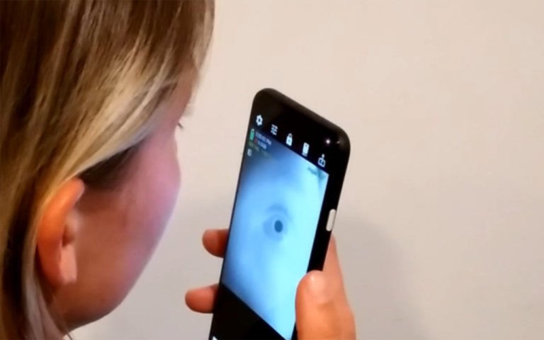 New eye-scanning app can screen people for Alzheimer’s, ADHD: researchers 