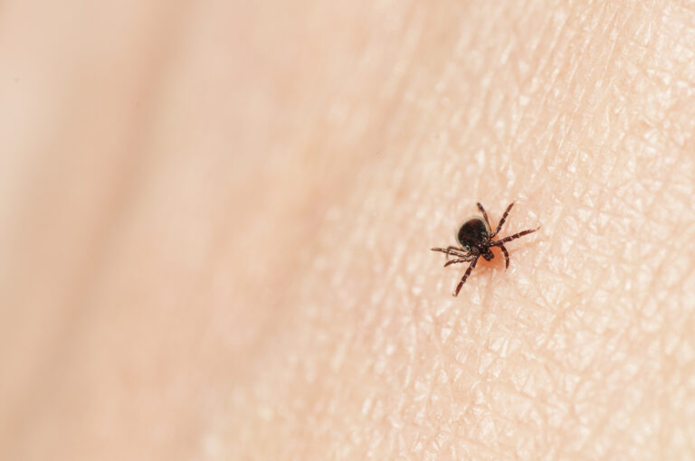 Tick season is here but experts say ‘no reason’ for Canadians to be overly concerned
