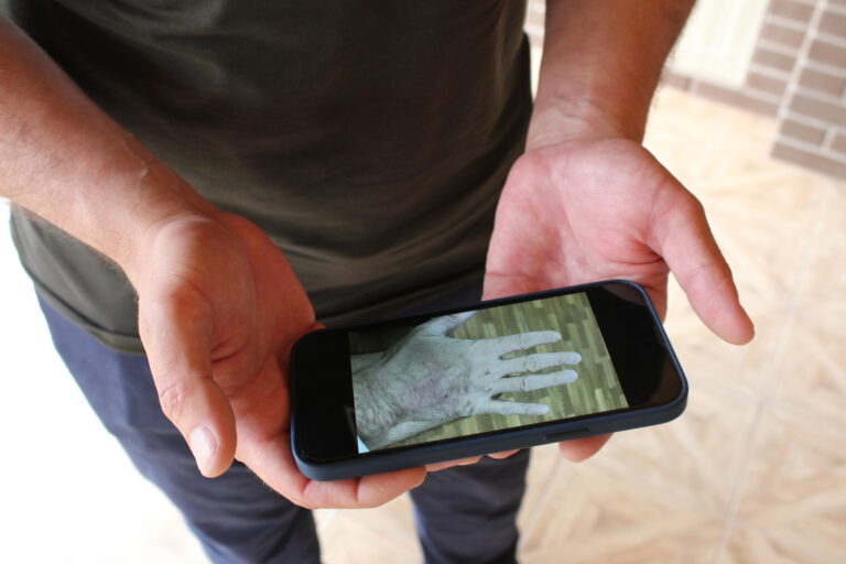 Ukrainian prisoner of war accuses Russia of torture