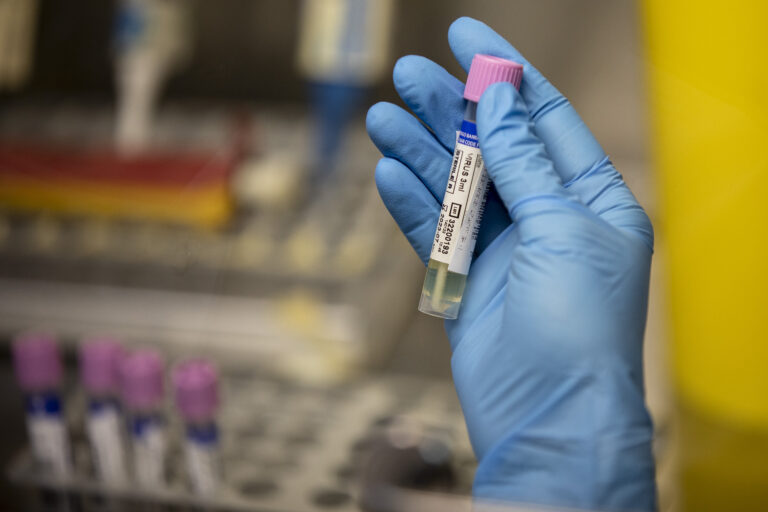 Canada signs $32.9M contract for smallpox drug with manufacturer Chimerix