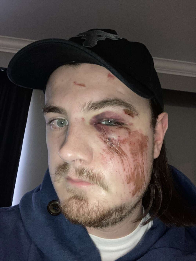 Hospital ‘nightmare’ in B.C. for Quebec patient denied surgery: father