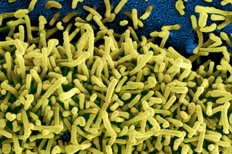 Marburg virus: How worried should Canadians be following Ghana’s outbreak?