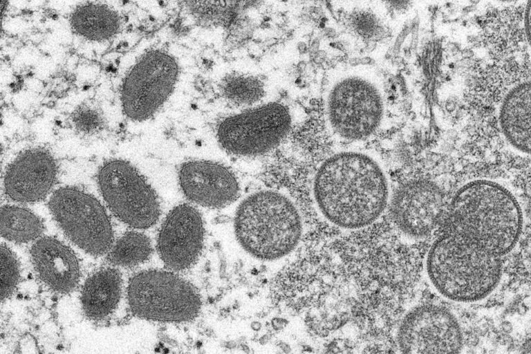 Monkeypox cases in Canada surpass 1K, with most in Ontario