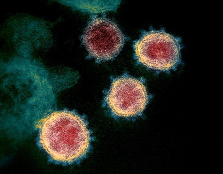 Canadian researchers discover ‘weak spot’ in COVID-19 virus key to treatments