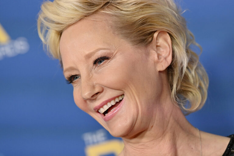 Anne Heche in coma following car crash, remains in critical condition