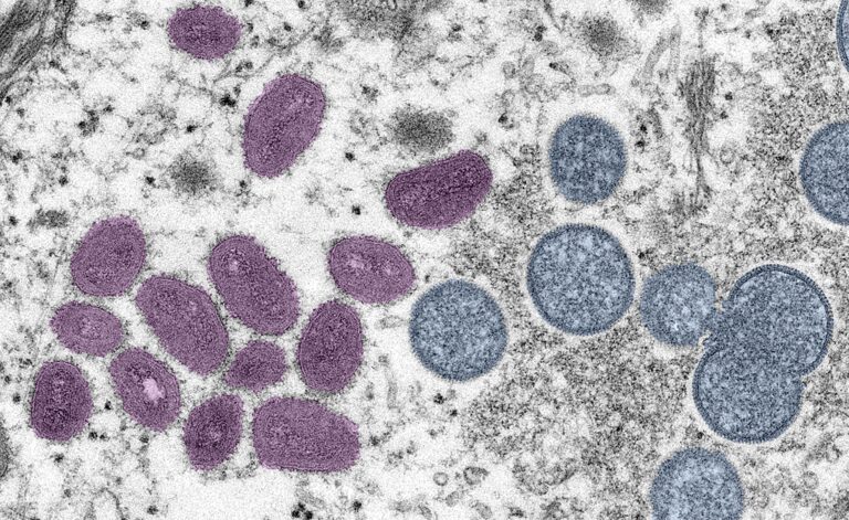 What you need to know about monkeypox in Saskatchewan