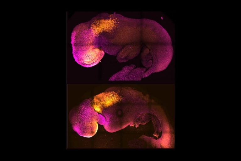 Synthetic embryos made without sperm or egg formed brain, beating heart: study