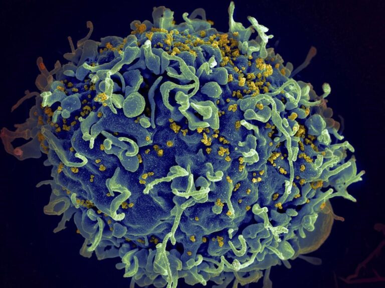 Halifax region records increase in number of people diagnosed with HIV: Public Health