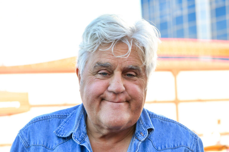 Jay Leno in hospital after suffering serious burns in gasoline fire