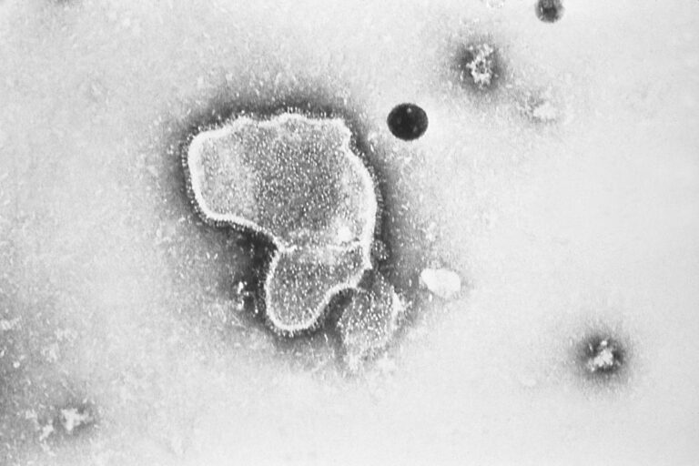 Vaccinating pregnant women with new RSV vaccine helped protect newborns: Pfizer