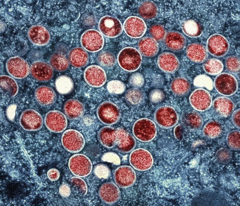 Monkeypox infections ‘steadily decreasing’ in Canada, PHAC declares