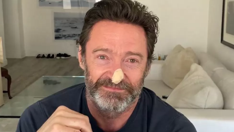 Hugh Jackman reveals new cancer scare, urges people to stop tanning