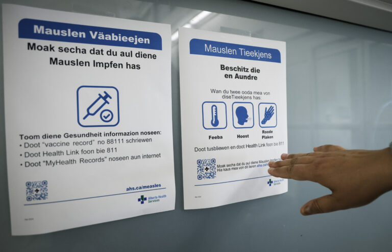 Canada can regain its measles elimination status. Here’s how