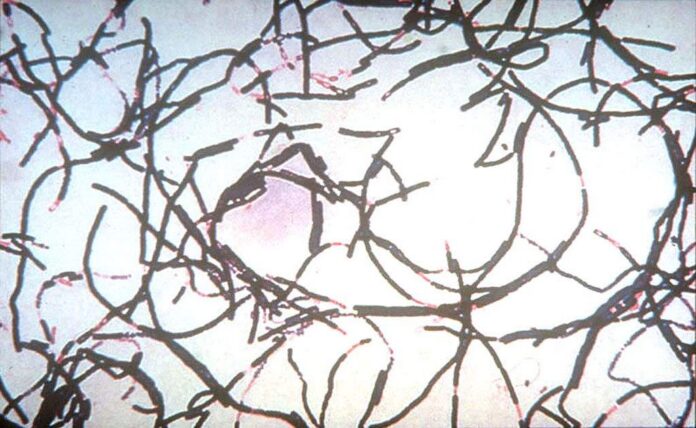 Anthrax outbreak kills more than 50 animals, infects 12 people in Zambia